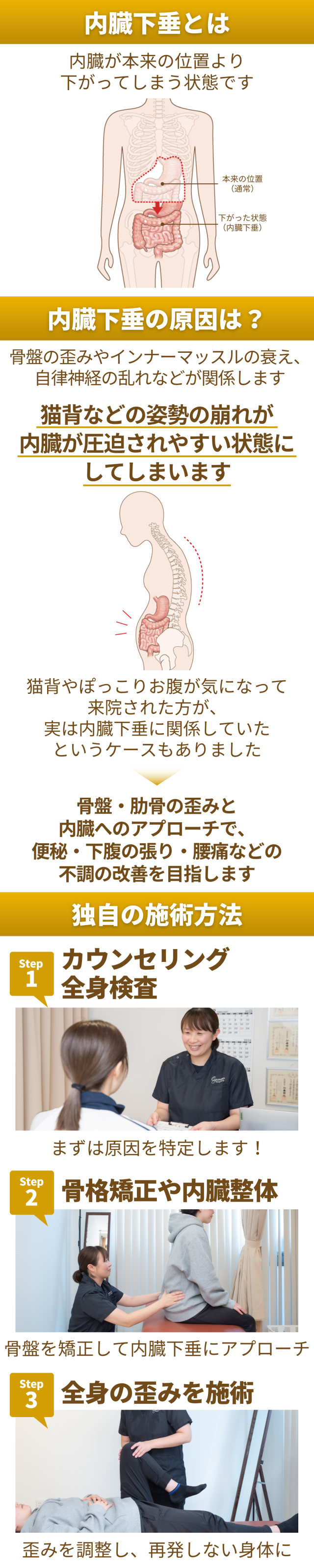 内臓下垂の治療コンセプト